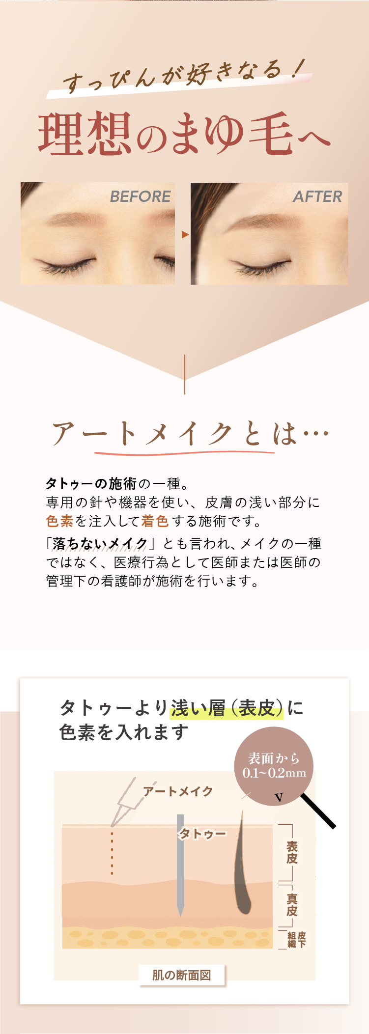 アートメイクはタトゥーよりも浅い層（表皮）に色素を入れる施術。表面から0.1〜0.2mmの浅さで、医師または看護師が行う医療行為